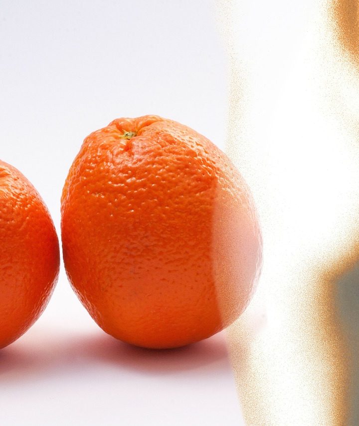 Strašiak celulitída sa dá poraziť